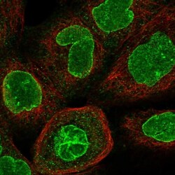 CCDC34 Antibody, Novus Biologicals 25 &mu;L, Unlabeled:Antibodies, Polyclonal